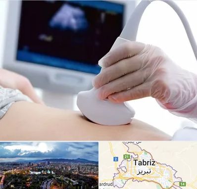 سونوگرافی در تبریز
