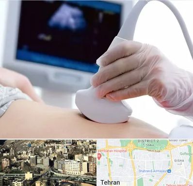 سونوگرافی در مرزداران