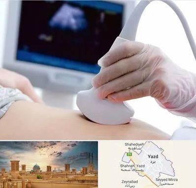 سونوگرافی در یزد