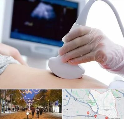 سونوگرافی در ولیعصر ارومیه