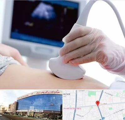 سونوگرافی در نصف راه تبریز