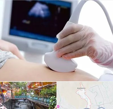 سونوگرافی در درکه