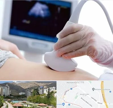 سونوگرافی در شهر زیبا