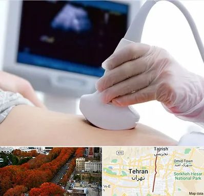 سونوگرافی در ولیعصر