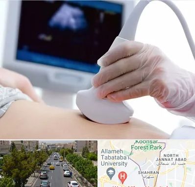 سونوگرافی در شهران