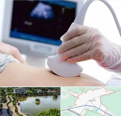 سونوگرافی در لنگرود