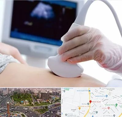 سونوگرافی در سبلان