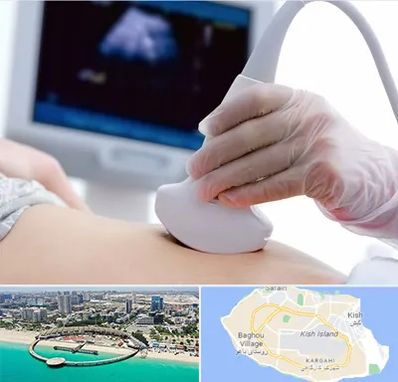 سونوگرافی در کیش