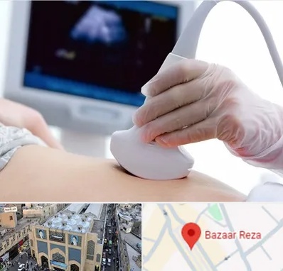 سونوگرافی در بازار رضا مشهد