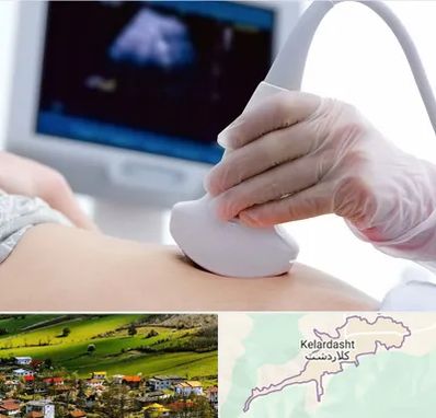 سونوگرافی در کلاردشت