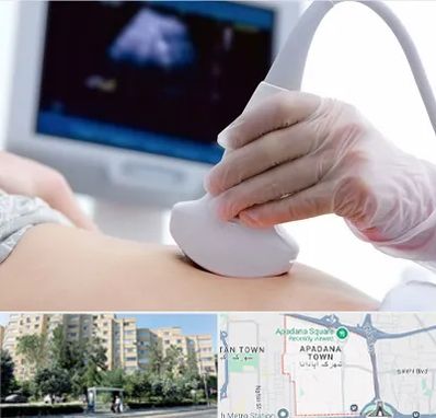 سونوگرافی در آپادانا