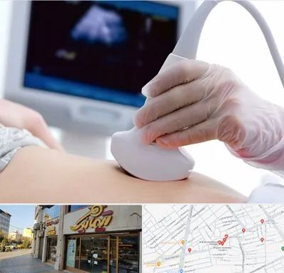 سونوگرافی در عطاران قم