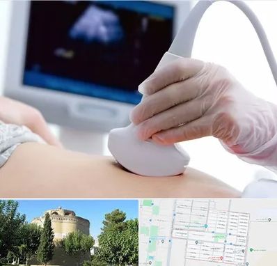 سونوگرافی در مرداویج اصفهان