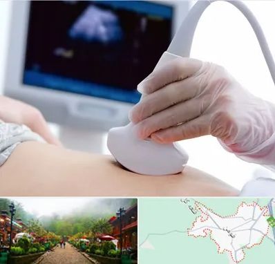 سونوگرافی در فومن