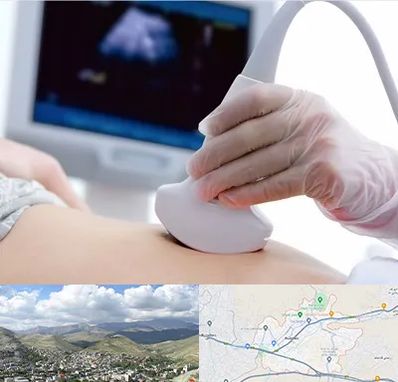 سونوگرافی در رودهن