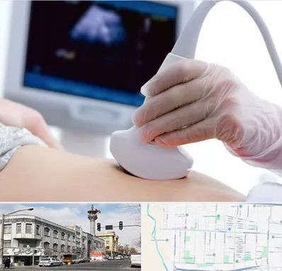سونوگرافی در 17شهریور