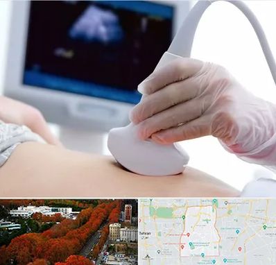 سونوگرافی در منطقه 6 تهران