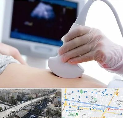 سونوگرافی در فرجام