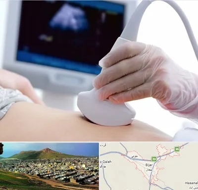 سونوگرافی در بیجار