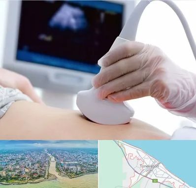 سونوگرافی در تنکابن