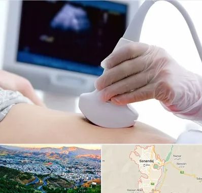 سونوگرافی در سنندج