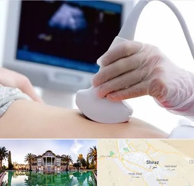 سونوگرافی در شیراز