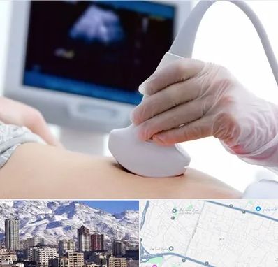 سونوگرافی در ازگل