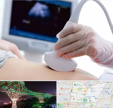 سونوگرافی در منطقه 3 تهران