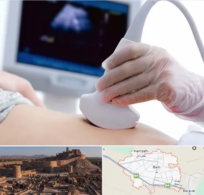 سونوگرافی در بم