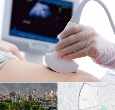 سونوگرافی در جمشیدیه