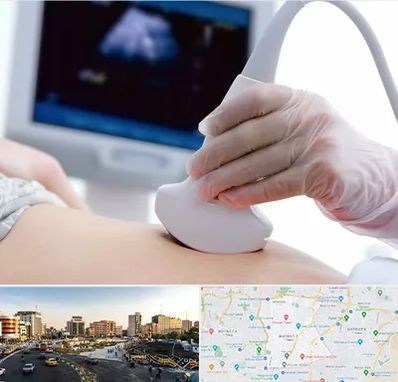 سونوگرافی در منطقه 7 تهران