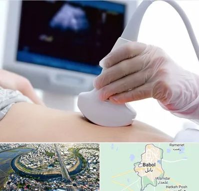 سونوگرافی در بابل
