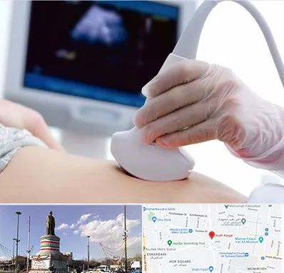 سونوگرافی در کارگر جنوبی