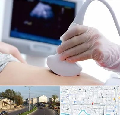 سونوگرافی در ضیابری رشت