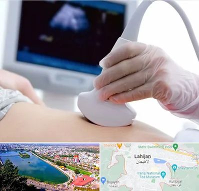 سونوگرافی در لاهیجان