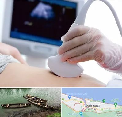 سونوگرافی در بندر انزلی