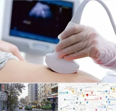 سونوگرافی در فاطمی