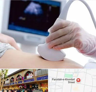 سونوگرافی در 15 خرداد