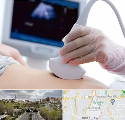 سونوگرافی در یوسف آباد