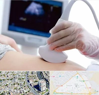 سونوگرافی در قاسم آباد مشهد