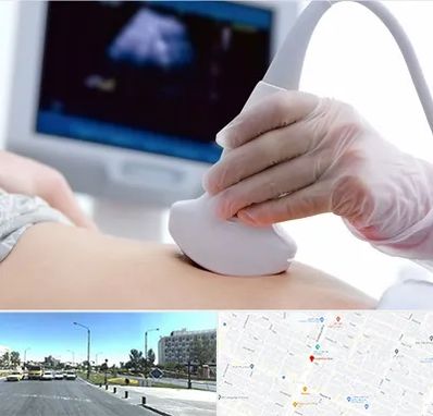 سونوگرافی در بلوار کلاهدوز مشهد