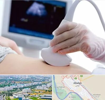 سونوگرافی در آبادان