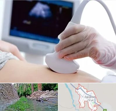 سونوگرافی در سراوان