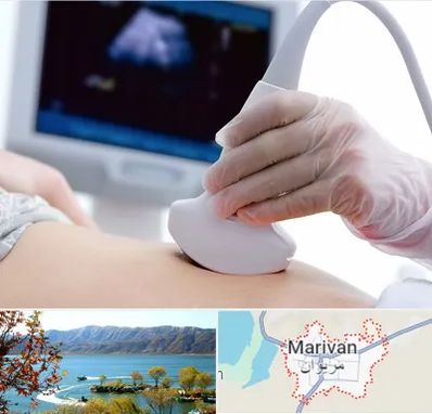 سونوگرافی در مریوان