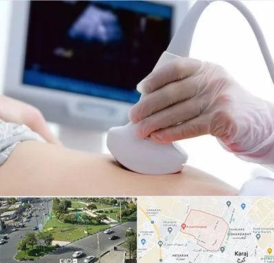 سونوگرافی در شاهین ویلا کرج