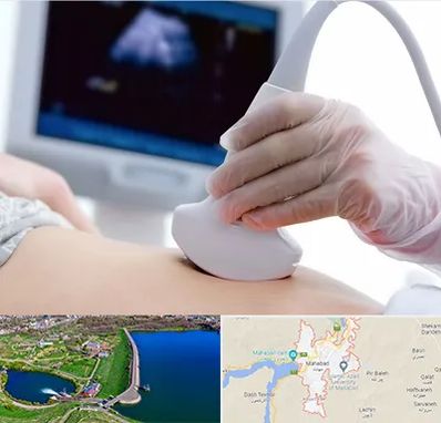 سونوگرافی در مهاباد