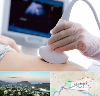 سونوگرافی در لواسان