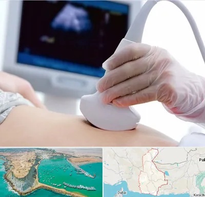 سونوگرافی در سیستان و بلوچستان