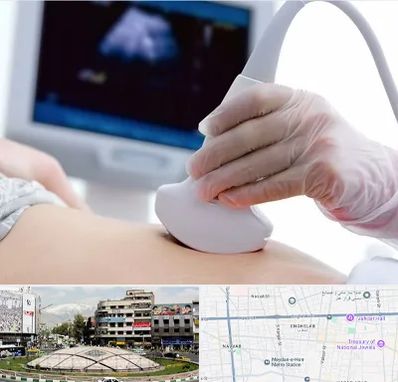 سونوگرافی در مرکز تهران