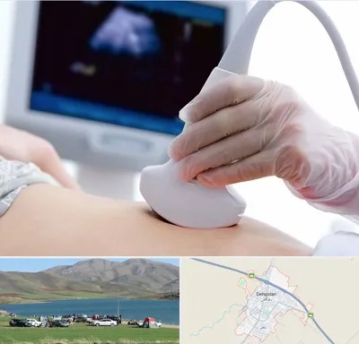 سونوگرافی در دهگلان